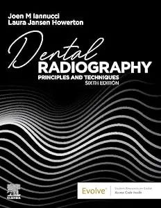 Dental Radiography: Principles And Techniques