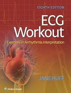 Ecg Workout: Exercises In Arrhythmia Interpretation