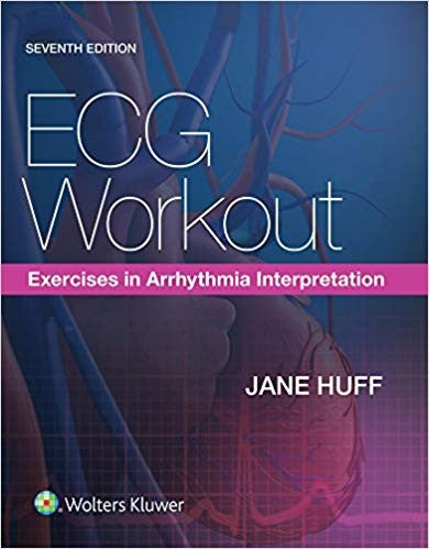 Ecg Workout: Exercises In Arrhythmia Interpretation